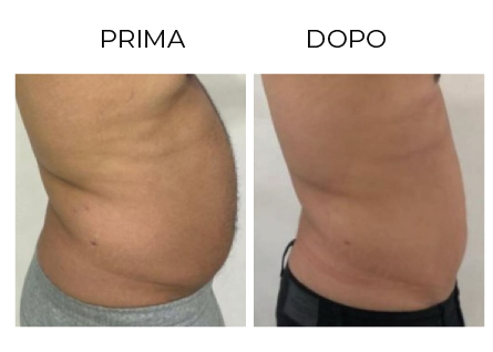 Cerbero Risultati Prima e Dopo 6