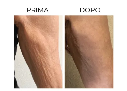 Cerbero Risultati Prima e Dopo 3