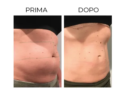 Cerbero Risultati Prima e Dopo 5