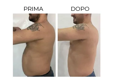 Cerbero Risultati Prima e Dopo 1