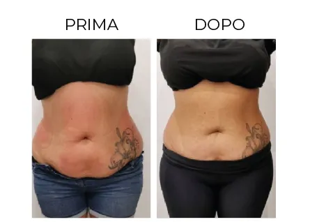Cerbero Risultati Prima e Dopo 2